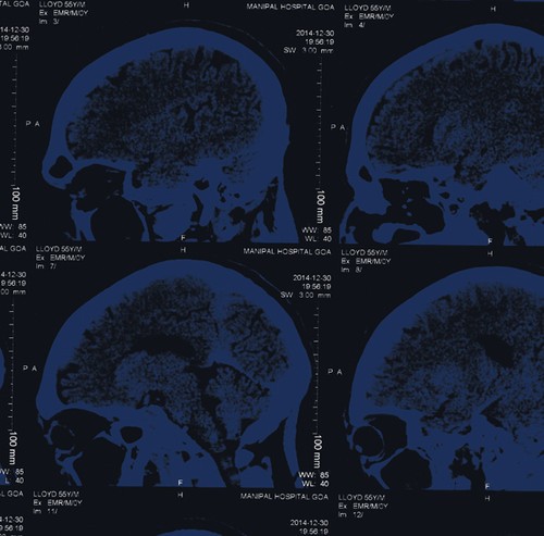 Nightingales - Mind Over Matter i gruppen VINYL / Rock hos Bengans Skivbutik AB (1318417)
