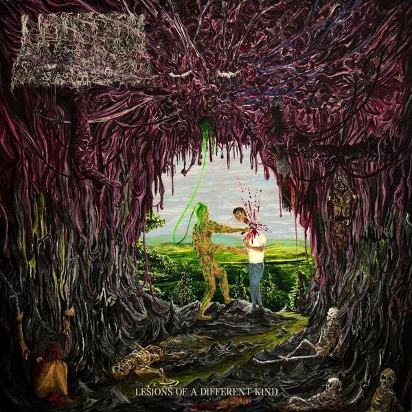 Undeath - Lesions Of A Different Kind i gruppen CD / Hårdrock/ Heavy metal hos Bengans Skivbutik AB (3848802)