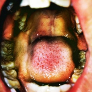 Hana Vu - Public Storage (Clear And White Mar i gruppen VINYL / Pop-Rock hos Bengans Skivbutik AB (4052085)