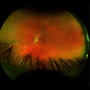 Puciato Greg - Mirrorcell (Black & Grey Splatter) i gruppen VINYL / Hårdrock hos Bengans Skivbutik AB (4186173)