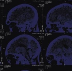 Nightingales - Mind Over Matter i gruppen ÖVRIGT / Övrigt / aub hos Bengans Skivbutik AB (1318416)