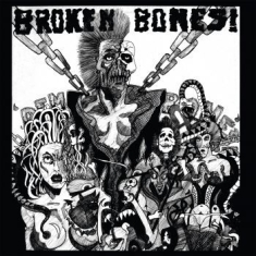 Broken Bones - Dem Bones