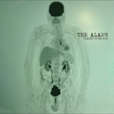 The Alarm - Transformation