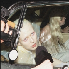 Static Dress - Injury Episode